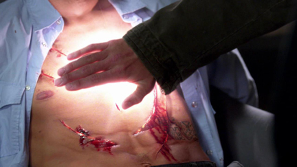 Zeke heals Cas, bringing him back to life. Zeke heals Cas, bringing him back to life.